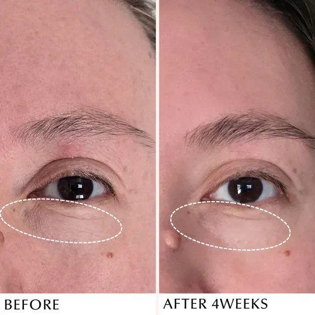 ALBION INFINESSE Derma Impact Cream