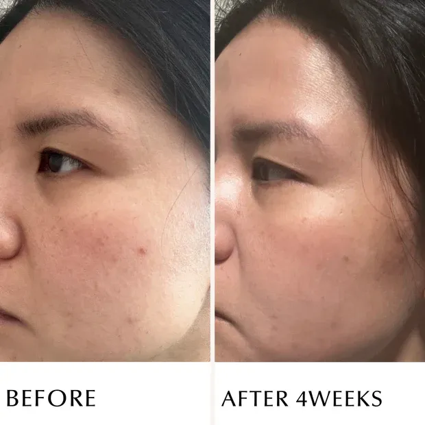 ALBION INFINESSE Derma Impact Cream