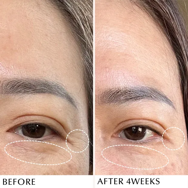 ALBION INFINESSE Derma Impact Cream