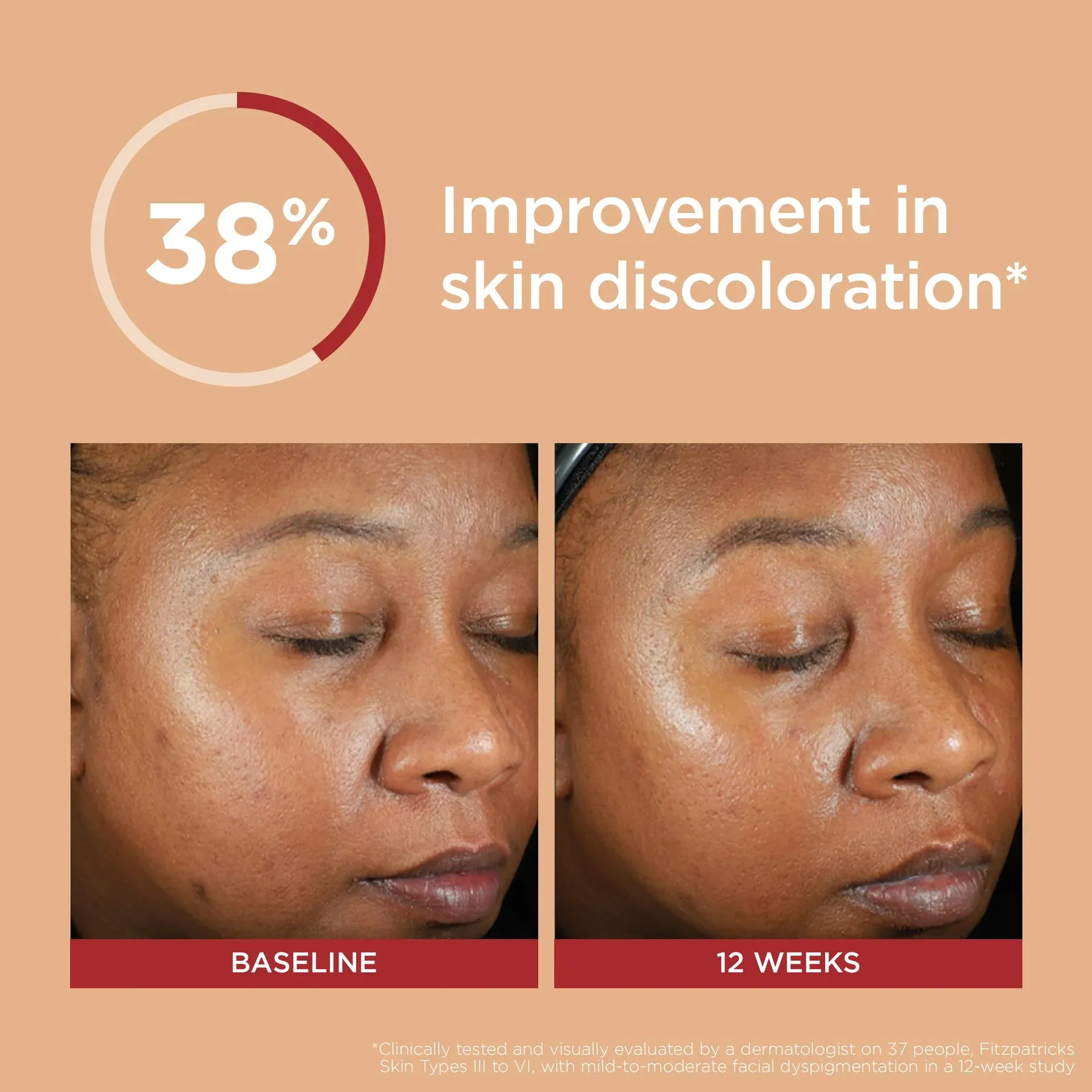 Elta MD UV Clear Deep Tinted Broad-Spectrum SPF 46