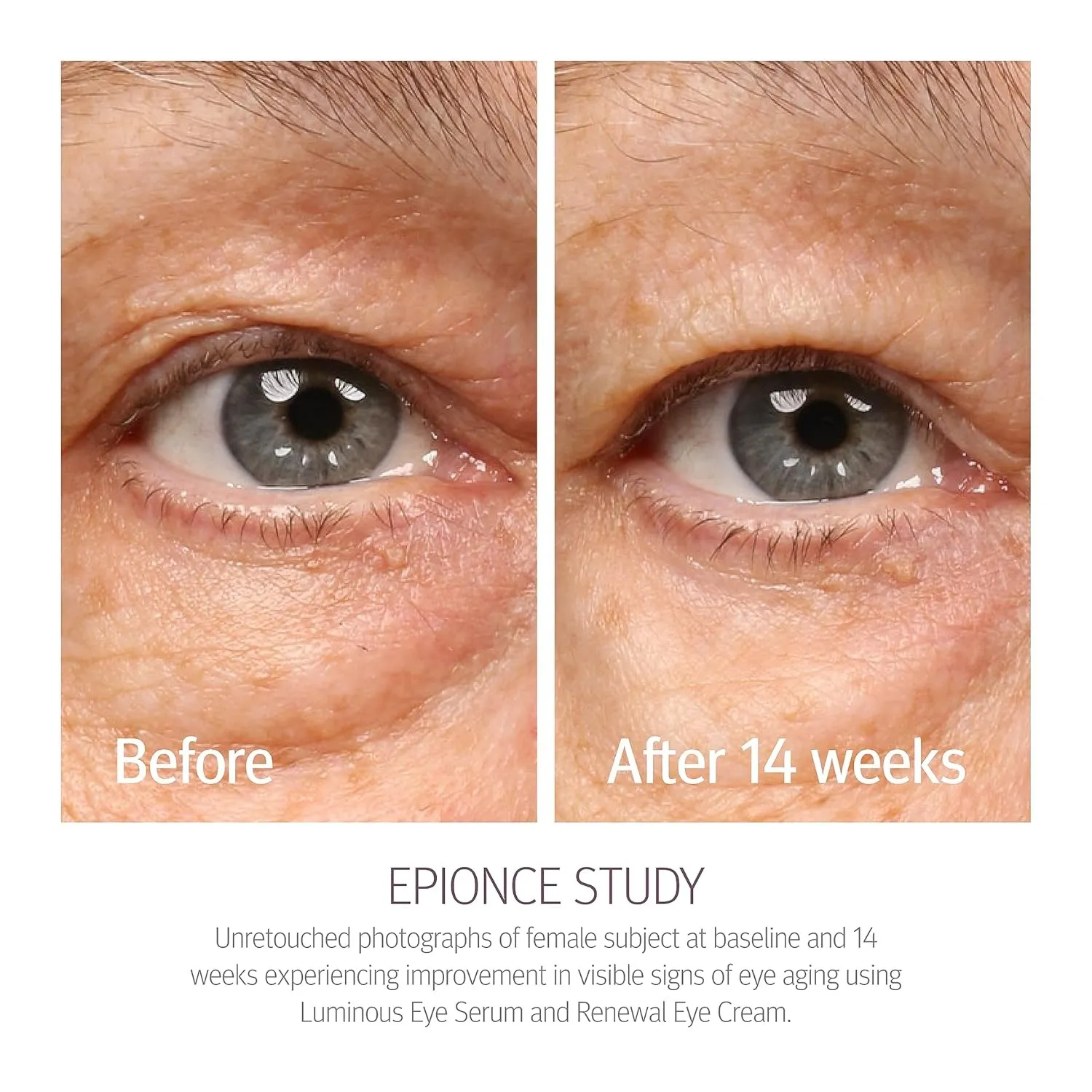 Epionce Renewal Eye Cream