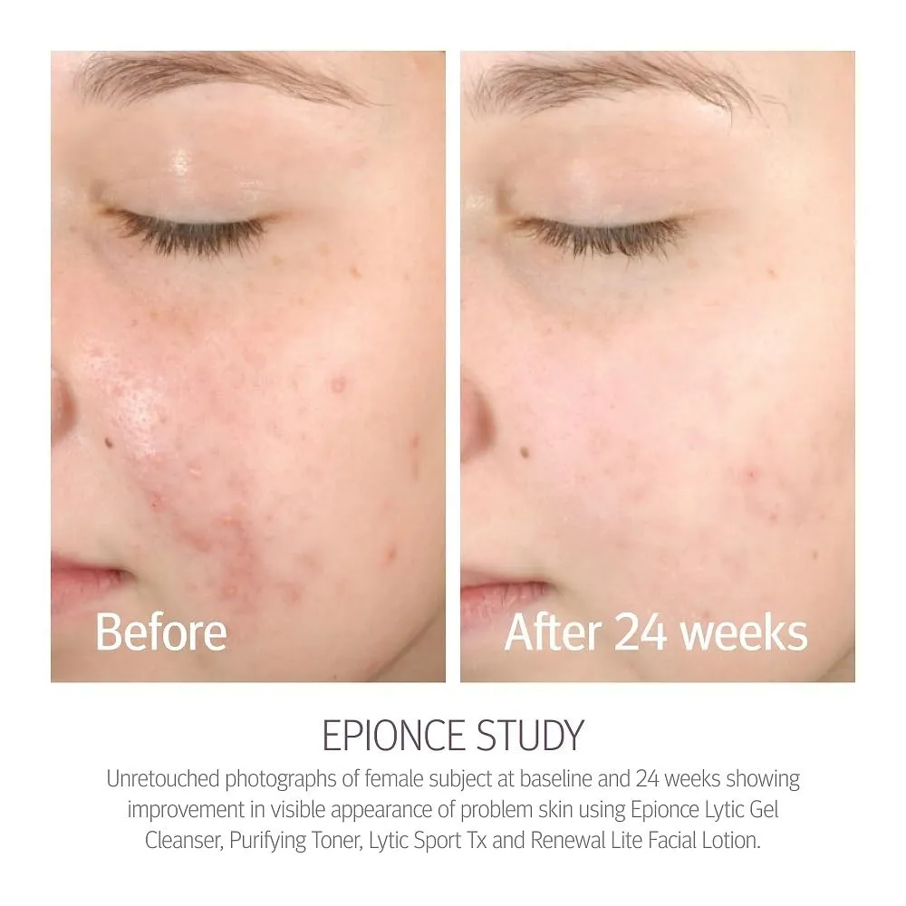 Epionce Renewal Lite Facial Lotion