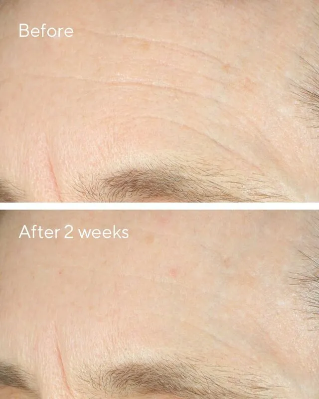 Murad Intense Recovery Cream
