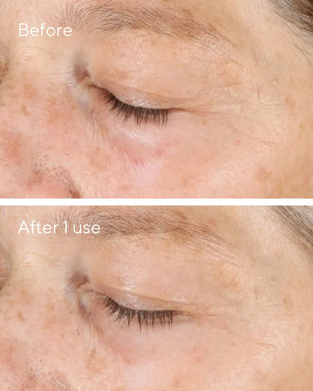Murad Vita-C Triple Exfoliating Facial