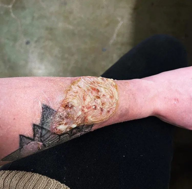 Pus Makeup Effect Gel