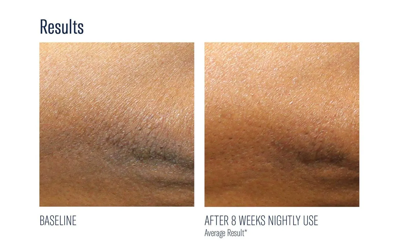 Skinbetter AlphaRet Body Overnight Cream