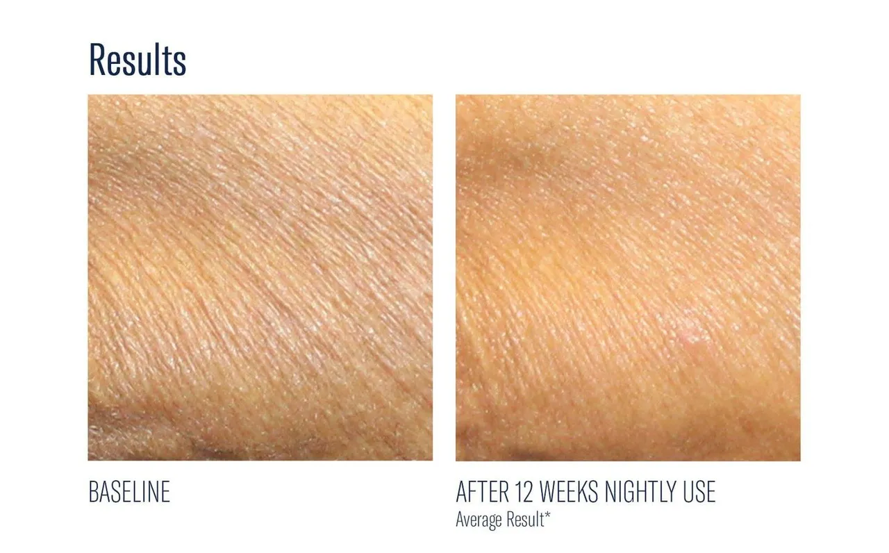 Skinbetter AlphaRet Body Overnight Cream