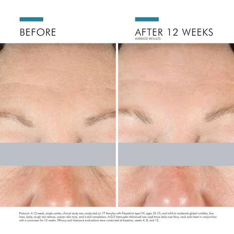 SkinCeuticals A.G.E. Interrupter Advanced