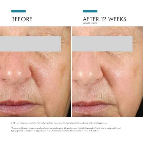 SkinCeuticals Daily Brightening UV Defense SPF 30