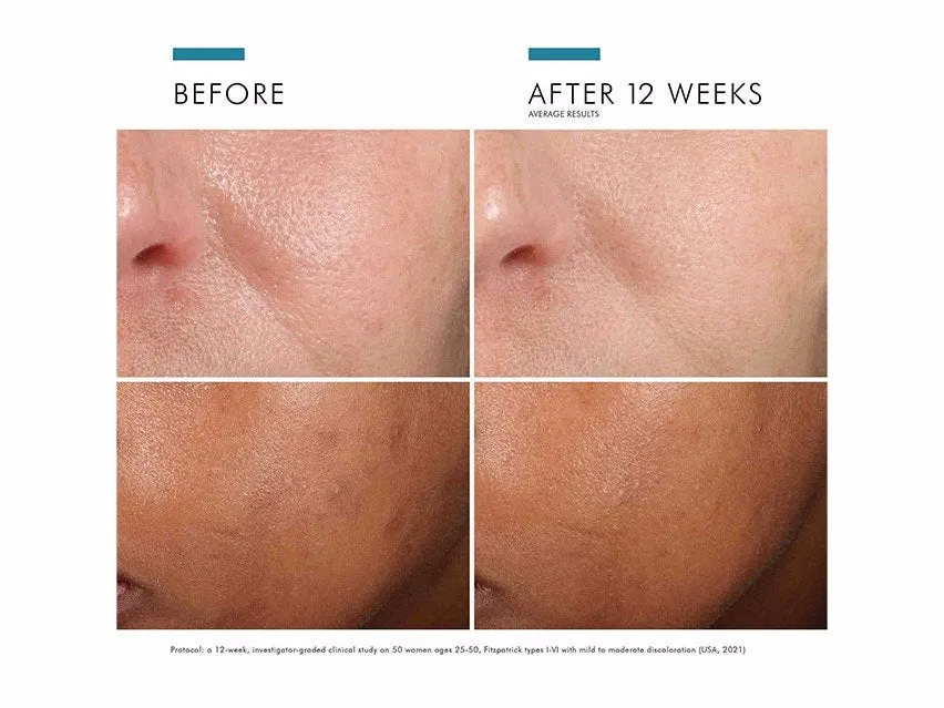SkinCeuticals Phloretin CF