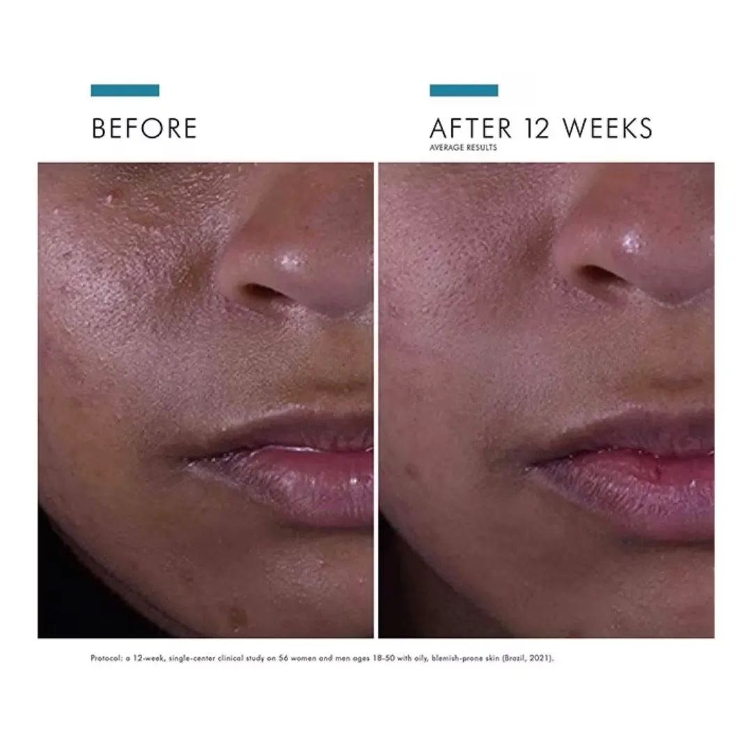 SkinCeuticals Silymarin CF